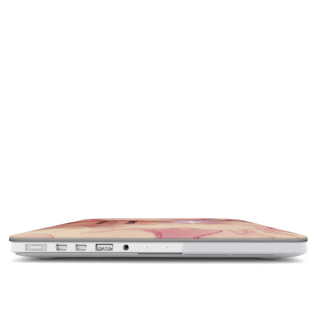 MacBook Case Shine with Confidence