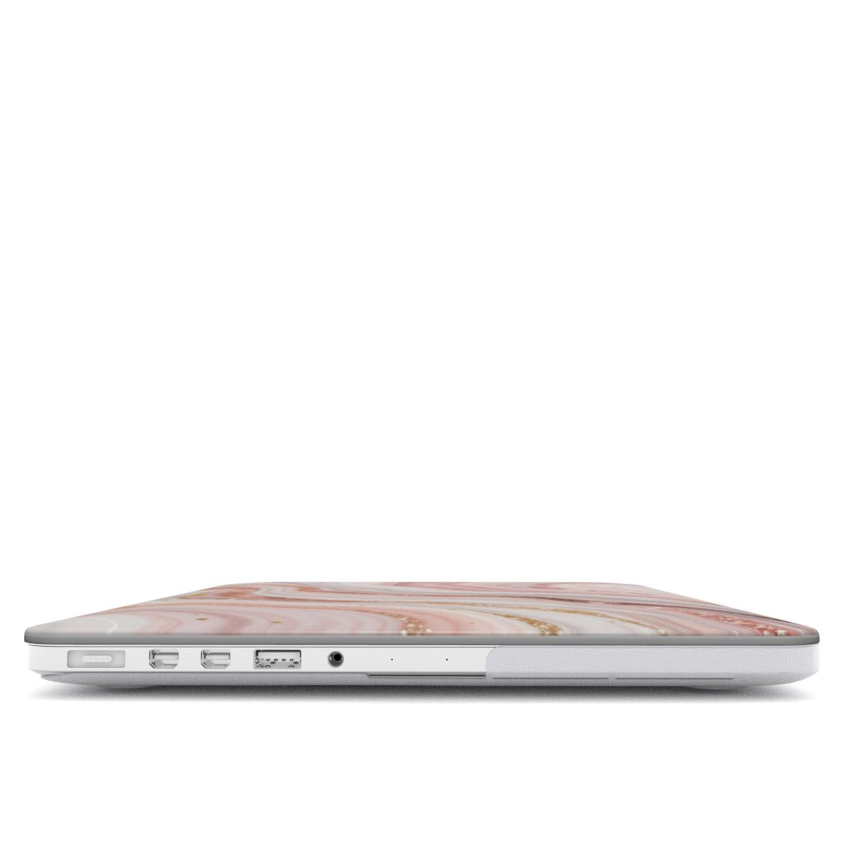 MacBook Case Rose Quartz Glow