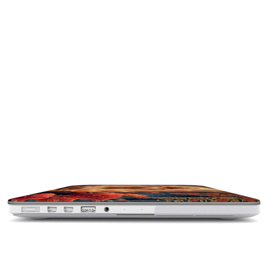 The Flame of Grace MacBook Case
